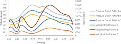 Study of Coronary Atherosclerosis Using Blood Residence Time